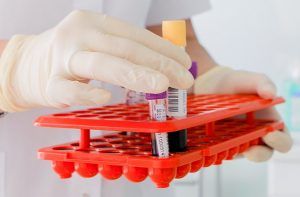 Эксперты рассказали о работе теста на антитела к коронавирусу. Фото: сайт мэра Москвы